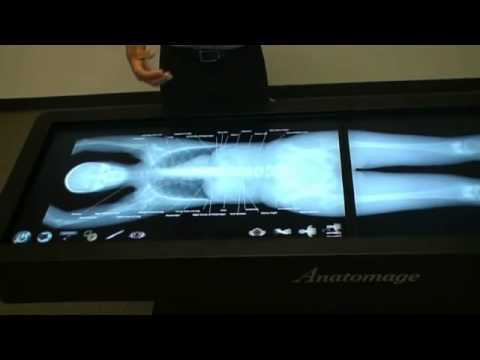 Интерактивный анатомический стол компания Anatomage.flv